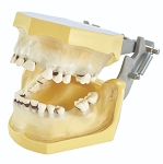 310 Periodontal Semi-Transparent Gingival Model with Natural Root Teeth, Calculus and MQD